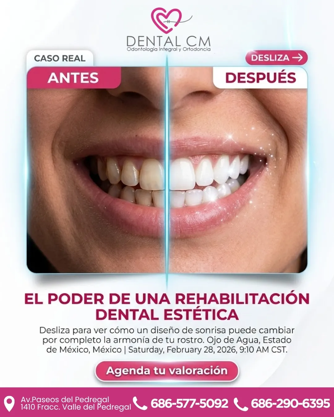 Diseño 70