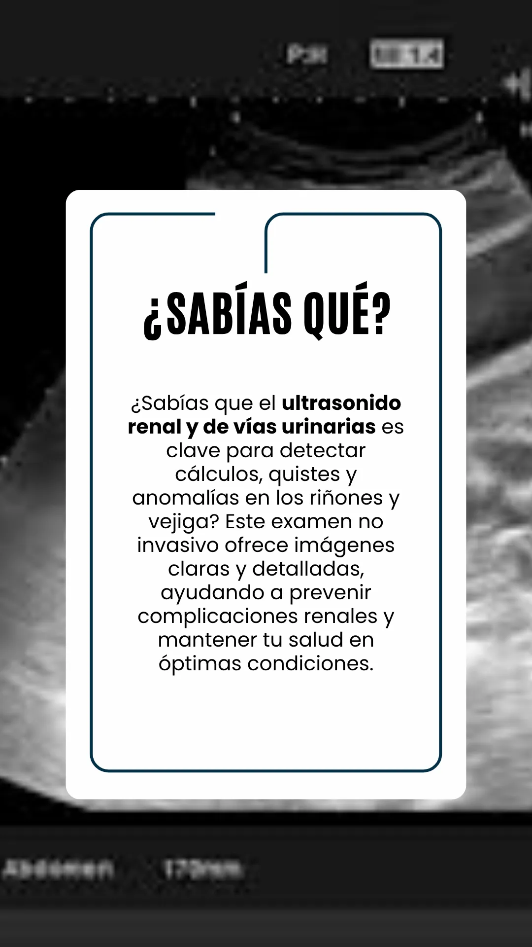 Diseño 15