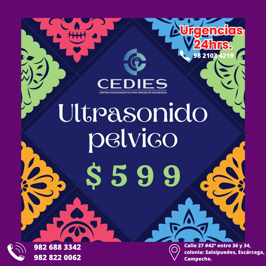 Diseño 51